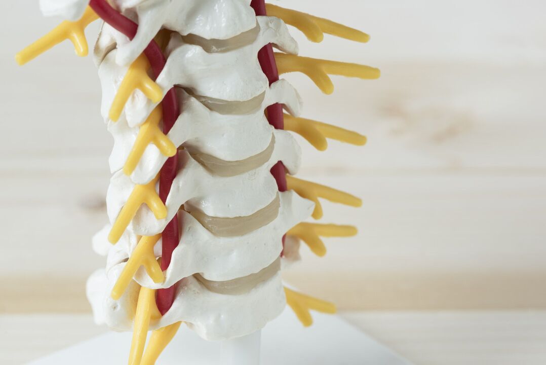 rysy cervikální osteochondrózy