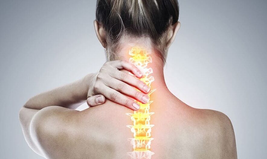 Osteochondróza krční páteře